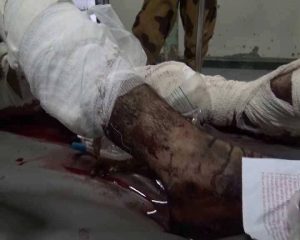 صور ضحايا مجزرة بيت سعدان - ارحب 
